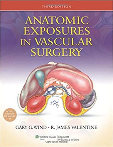 okumak Anatomic Exposures in Vascular Surgery