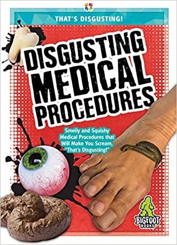 okumak Disgusting Medical Procedures (Thats Disgusting!)