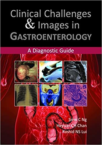 okumak Clinical Challenges and Images in Gastroenterology
