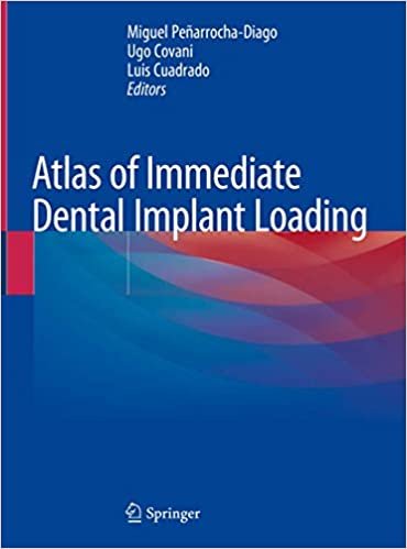 okumak Atlas of Immediate Dental Implant Loading