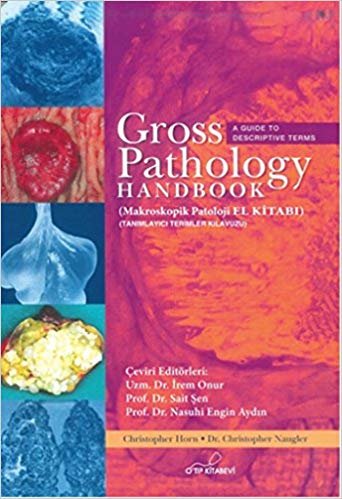 okumak Gross Pathology Handbook: Makroskopik Patoloji El Kitabı