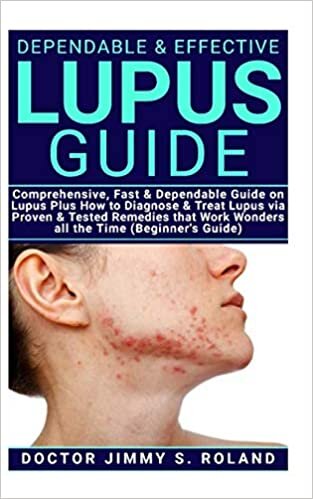 okumak Dependable &amp; Effective Lupus Guide: Comprehensive, Fast &amp; Dependable Guide on Lupus Plus How to diagnose &amp; Treat Lupus via Proven &amp; Tested Remedies that Work Wonders all the Time (Beginner’s Guide)