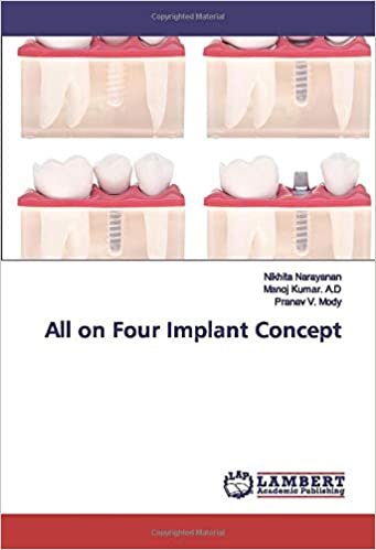 okumak All on Four Implant Concept