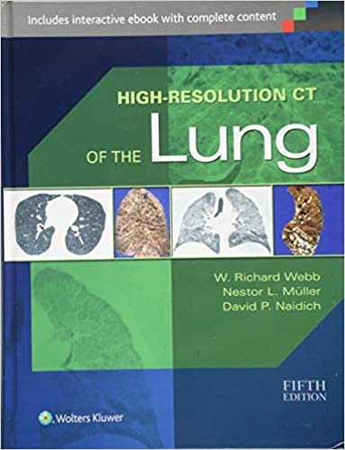 okumak High-Resolution CT of the Lung