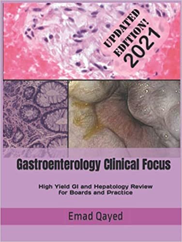 okumak Gastroenterology Clinical Focus: High yield GI and hepatology review- for Boards and Practice - 2nd edition