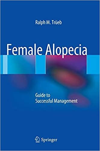 okumak Female Alopecia : Guide to Successful Management