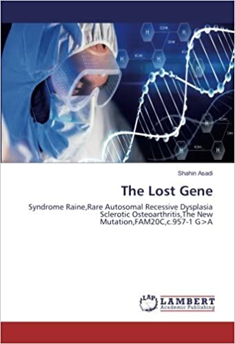 okumak The Lost Gene: Syndrome Raine,Rare Autosomal Recessive Dysplasia Scl Osteoarthritis,The New Mutation,FAM20C,c.957-1 G&gt;A