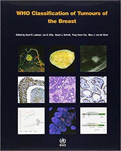 okumak WHO classification of tumours of the breast : 4
