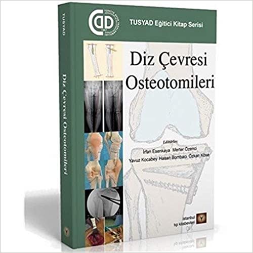 okumak Diz Çevresi Osteotomileri: TUSYAD Eğitici Kitap Serisi