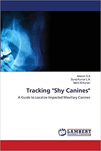 okumak Tracking &quot;Shy Canines&quot;: A Guide to Localize Impacted Maxillary Canines