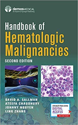 okumak Handbook of Hematologic Malignancies