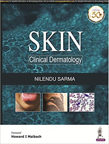 okumak Sarma, N: Skin