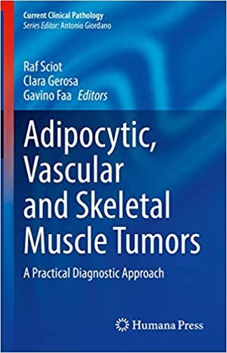 okumak Adipocytic, Vascular and Skeletal Muscle Tumors: A Practical Diagnostic Approach (Current Clinical Pathology)
