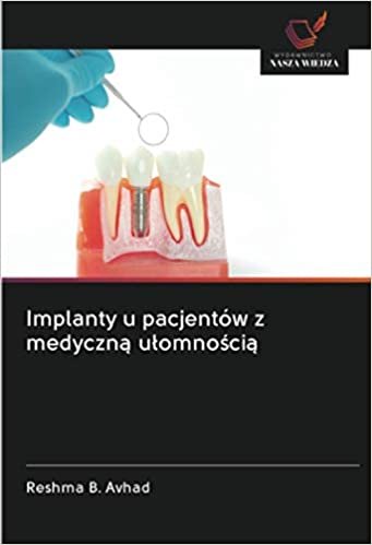 okumak Implanty u pacjentów z medyczną ułomnością