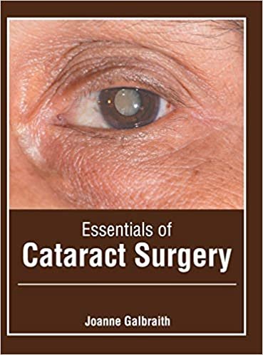 okumak Essentials of Cataract Surgery
