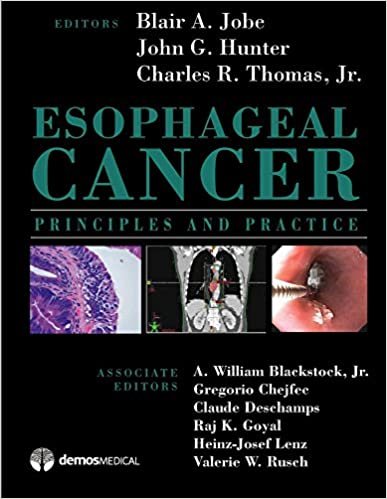 okumak Esophageal Cancer: Principles and Practice