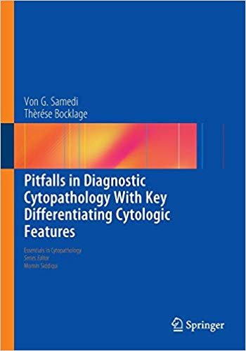 okumak Pitfalls in Diagnostic Cytopathology With Key Differentiating Cytologic Features : 27