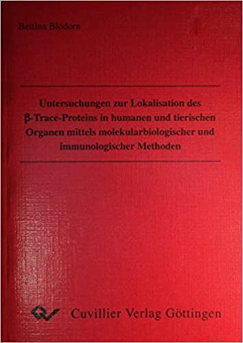 okumak Untersuchungen zur Lokalisation des 


(Almanca) Perfect Binding Cilt – 1 Ocak 1996