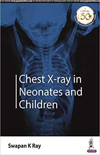 okumak Chest X-ray in Neonates and Children