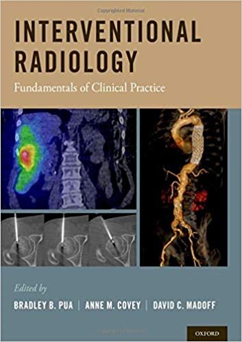 okumak Interventional Radiology: Fundamentals of Clinical Practice