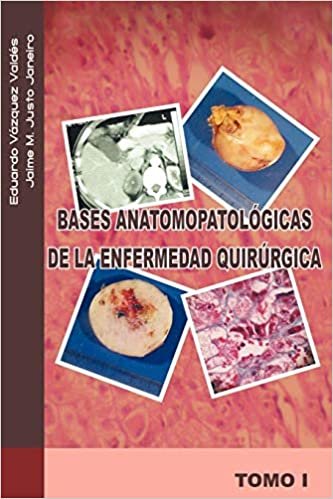 okumak Bases anatomopatológicas de la enfermedad quirúrgica: Tomo i