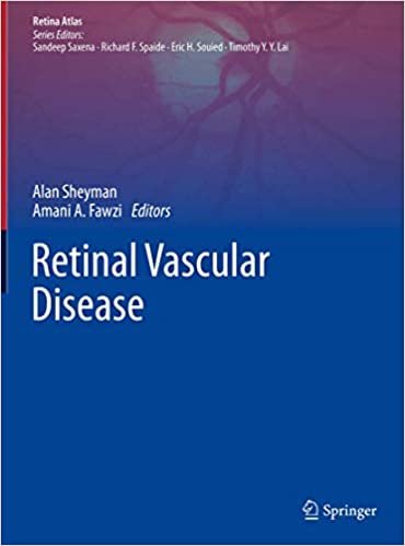 okumak Retinal Vascular Disease (Retina Atlas)
