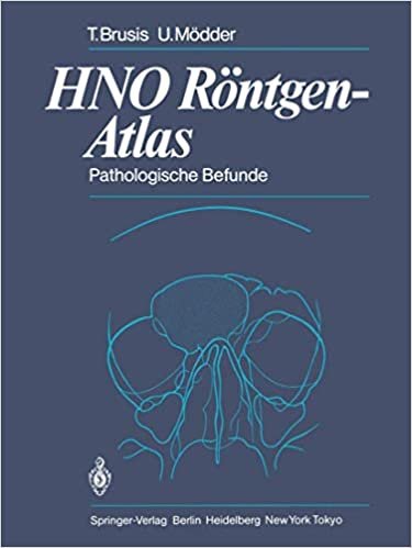 okumak H.N.O. Röntgen-Atlas: Pathologische Befunde (German Edition)