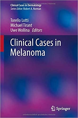 okumak Clinical Cases in Melanoma (Clinical Cases in Dermatology)