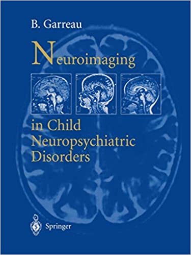 okumak Neuroimaging in child neuropsychiatric disorders