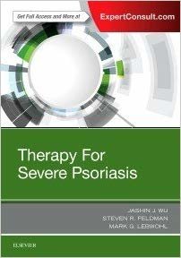 okumak Therapy for Severe Psoriasis (1st Edition)