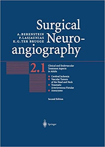 okumak Surgical Neuroangiography: Clinical and Endovascular Treatment Aspects in Adults v. 2 (Surgical Neuroangiography)