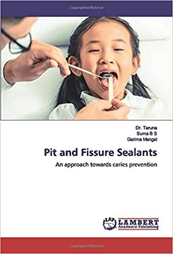 okumak Pit and Fissure Sealants: An approach towards caries prevention