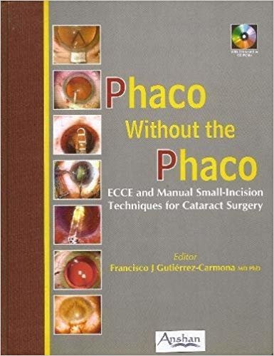 okumak PHACO WITHOUT THE PHACO : ECCE AND MANUAL SMALL-INCISION TECHNIQUES FOR CATARACT