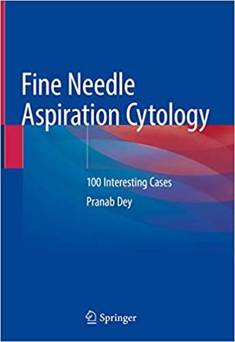 okumak Fine Needle Aspiration Cytology: 100 Interesting Cases