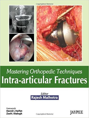 okumak Malhotra, R: Mastering Orthopedic Techniques: Intra-Articula