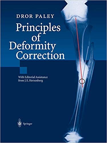 okumak Principles of Deformity Correction
