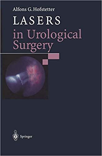 okumak Lasers in Urological Surgery