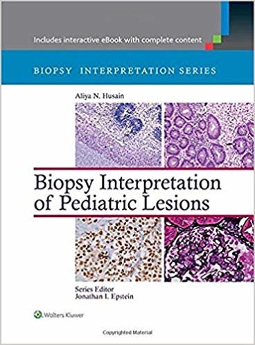 okumak Biopsy Interpretation of Pediatric Lesions