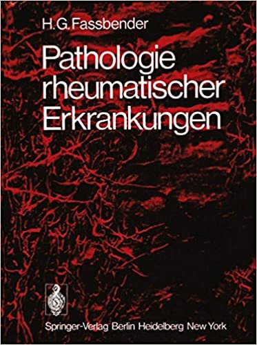 okumak Pathologie rheumatischer Erkrankungen (German Edition)