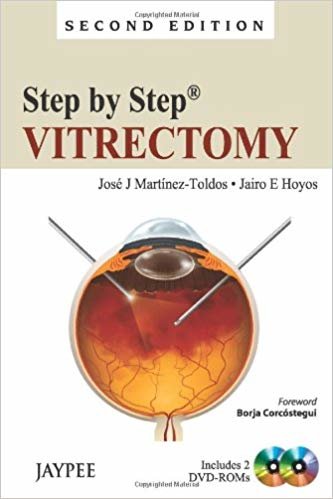 okumak Step by Step: Vitrectomy