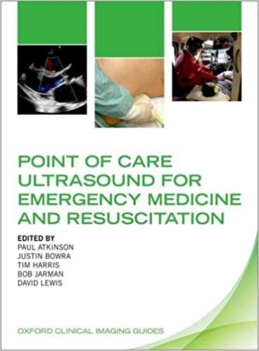 okumak Atkinson, P: Point of Care Ultrasound for Emergency Medicine (Oxford Clinical Imaging Guides)