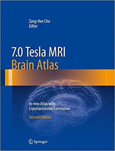okumak 7.0 Tesla MRI Brain Atlas : In-vivo Atlas with Cryomacrotome Correlation