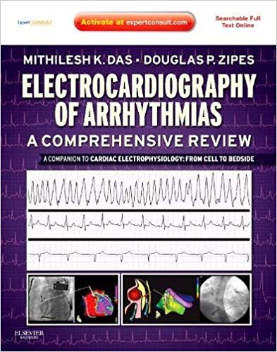 okumak Electrocardiography of Arrhythmias: A Comprehensive Review, 1st Edition