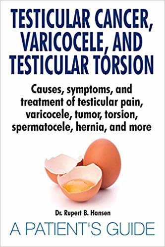 okumak Testicular Cancer, Varicocele, and Testicular Torsion. Causes, symptoms, and treatment of testicular pain, varicocele, tumor, torsion, spermatocele, hernia, and more. A Patients Guide