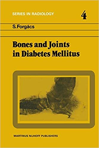 okumak Bones and Joints in Diabetes Mellitus (Series in Radiology)
