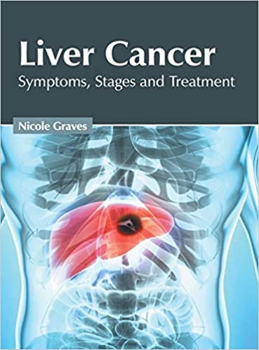 okumak Liver Cancer: Symptoms, Stages and Treatment