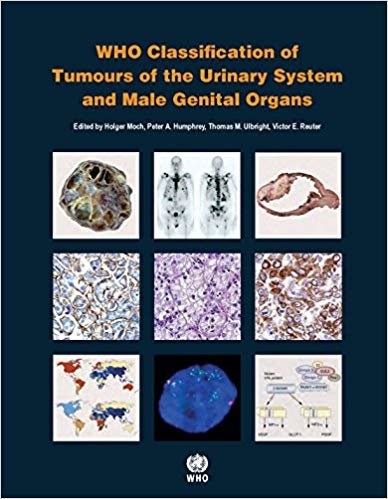 okumak WHO Classification Of Tumours of the Urinary System and Male Genital Organs