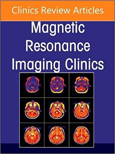 okumak MR Imaging of the Adnexa, An Issue of Magnetic Resonance Imaging Clinics of North America (Volume 31-1) (The Clinics: Radiology, Volume 31-1)