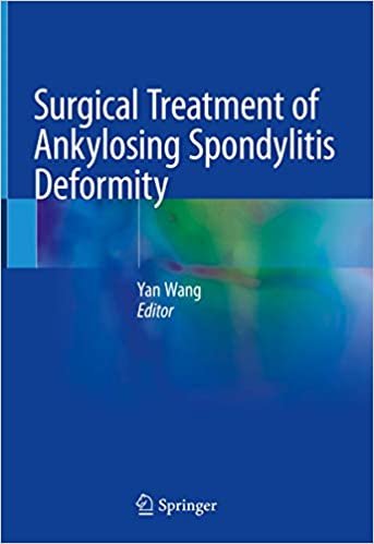 okumak Surgical Treatment of Ankylosing Spondylitis Deformity