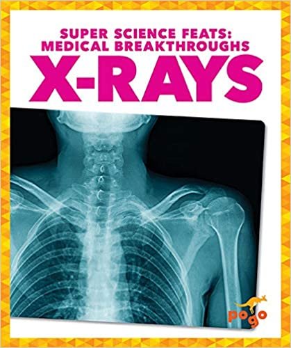 okumak X-Rays (Super Science Feats: Medical Breakthroughs)